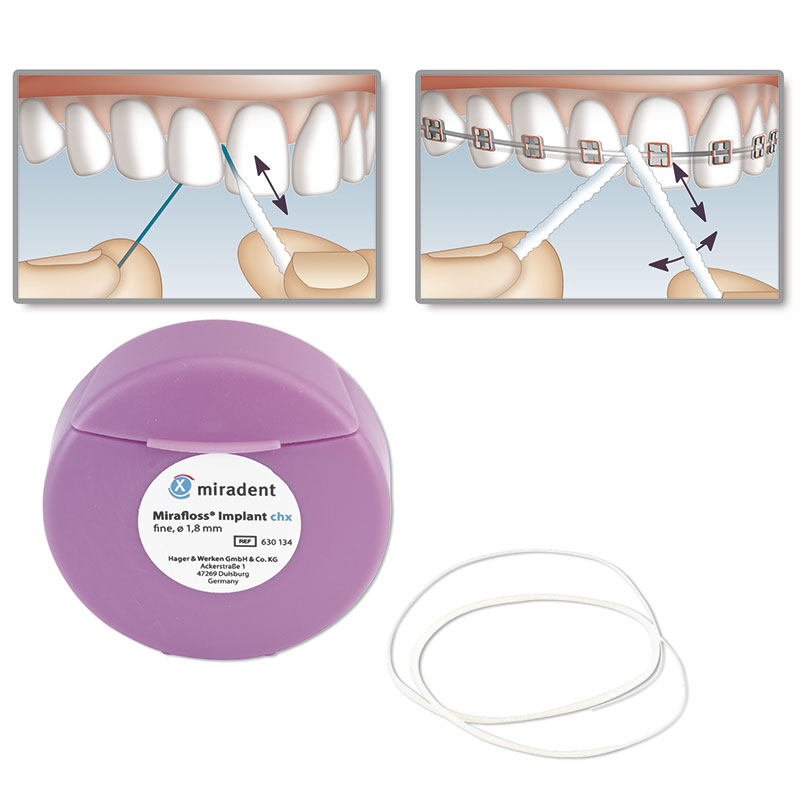 Зубной флосс MIRAFLOSS Implant chx 2,2 мм для имплантов и мостовидных протезов (средний), Miradent