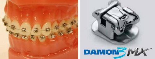 Брекет ортодонтический, модель DAMON 3MX  (022 паз) ORMCO, Мексика